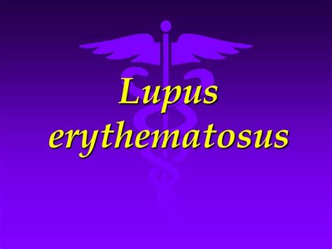 Ppt Lupus Erythematosus Powerpoint Presentation Free Download Id