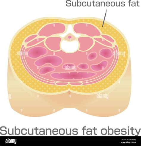 Subcutaneous Fat High Resolution Stock Photography And Images Alamy