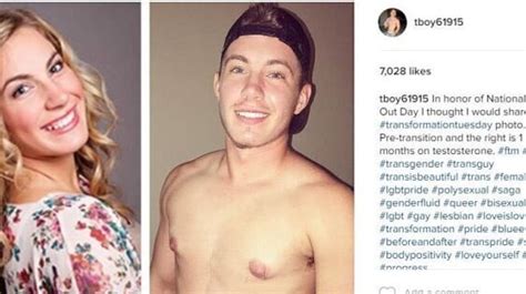 Trans Man S Before And After Photos Prove There S No One Way To Look Transgender Huffpost Life