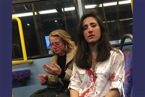 Lesbian Couple Brutally Attacked For Refusing Gang Of Thugs Demand That They Kiss Lgbtq Nation