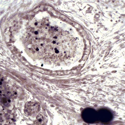 Lactating Human Mammary Gland Light Micrograph Stock Image C