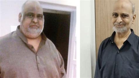 Hyderabad Man Wins Battle Of The Bulge Sheds Kg In Years After Bariatric Surgery Latest