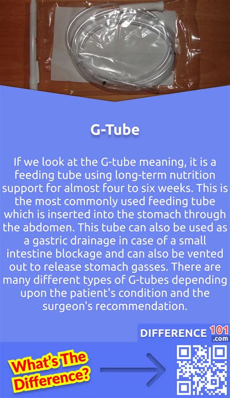 J Tube Vs G Tube 5 Key Differences Pros And Cons Similarities