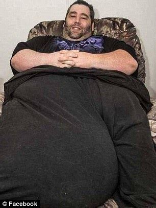 Dan Maurer With Lb Scrotum Has Hour Surgery To Remove The Giant Mass Daily Mail Online