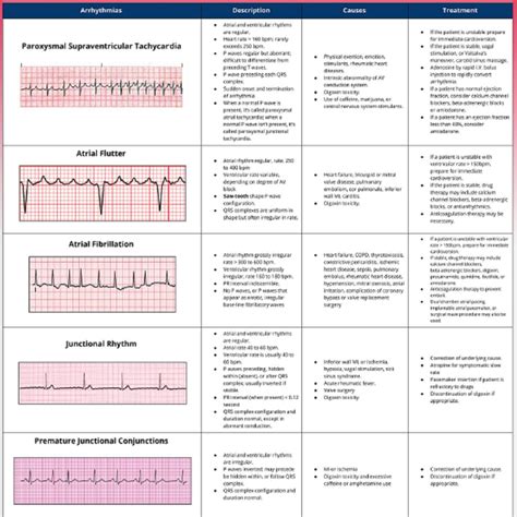 Cardiac Rhythm Cheat Sheet