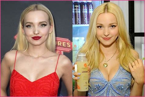 Dove Cameron Plastic Surgery Before And After Photos