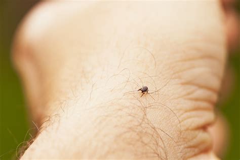 Tick Bites When Should I Worry