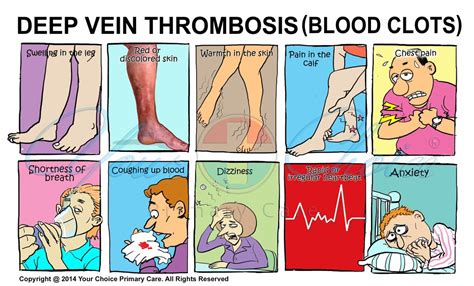 Dvt Your Choice Primary Care You Choi Md Internal Medicine