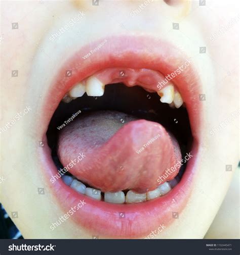 Parts Human Body Teeth Tongue Ears Stock Photo 1102445471 Shutterstock