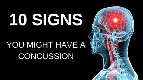10 Signs You Might Have A Concussion Personal Injury Law Firm Dallas