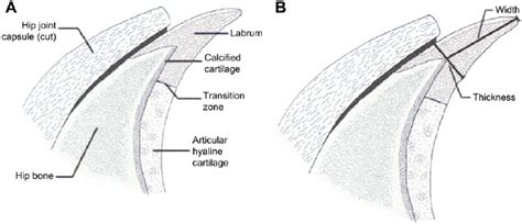 The shoulder joint (glenohumeral joint) is a ball and socket joint between the scapula and the the transverse humeral ligament is not shown on this diagram. Cross section of acetabular labrum. ( A ) Labral attachment. ( B )... | Download Scientific Diagram