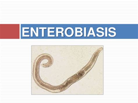 Pinworm Enterobius Vermicularis Signs And Symptoms Diagnostic And Treatment