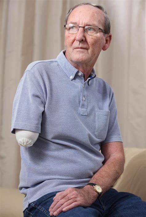 Delivery Man Tells Of Devastating Choice To Amputate Arm After Being