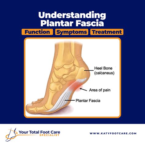 Understanding Plantar Fascia