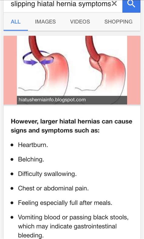 Slipping Hiatal Hernia Symptoms Hernia Symptoms Nursing Flashcards