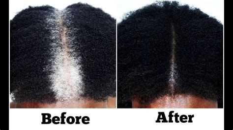 Also, the product should come in a form that assists you instead of making your job hard. How To Turn White Or Grey Hair Into Black Naturally No ...