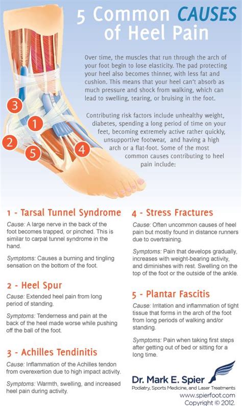 Foot Pain Chart Understanding The Causes And Remedies For Different