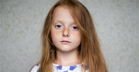 Are Babies Born With Freckles Experts Explain How The Sweet Markings
