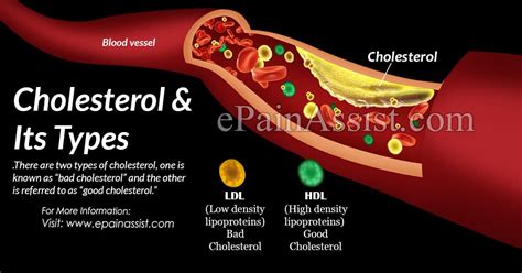Three types of t tests. Types of Cholesterol, Its Causes, Symptoms, Treatment ...