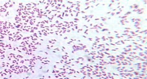 The severity of the disease depends on host factors. Gram's staining test S.Typhi | Download Scientific Diagram