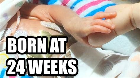 Born At 24 Weeks Micro Preemie Documentary Youtube