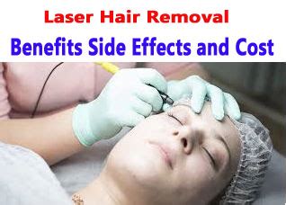 Laser Hair Removal Benefits Side Effects And Cost Healthfitns
