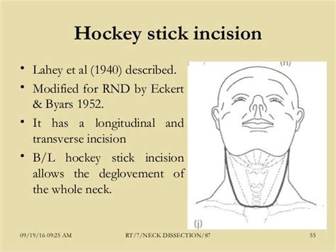 7 Neck Dissection87 Dr Rahul Tiwari