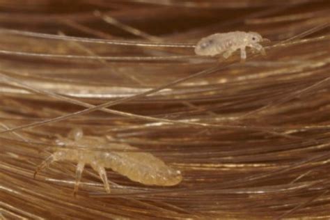 5 Things You Should Know About Lice Williamson Source