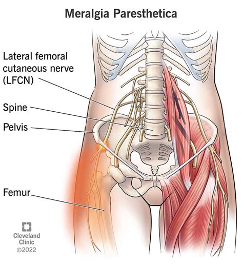 Lateral Femoral Cutaneous Nerve Orthopaedicprinciples The Best Porn
