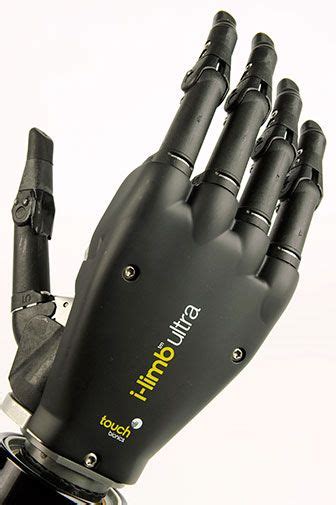 I Limb Ultra Arm Prosthesis From Touch Bionics Technology Bionic