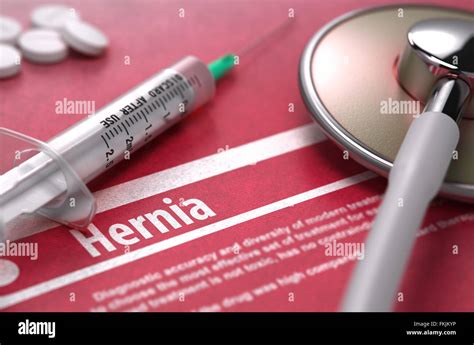 Inguinal Hernia Hi Res Stock Photography And Images Alamy