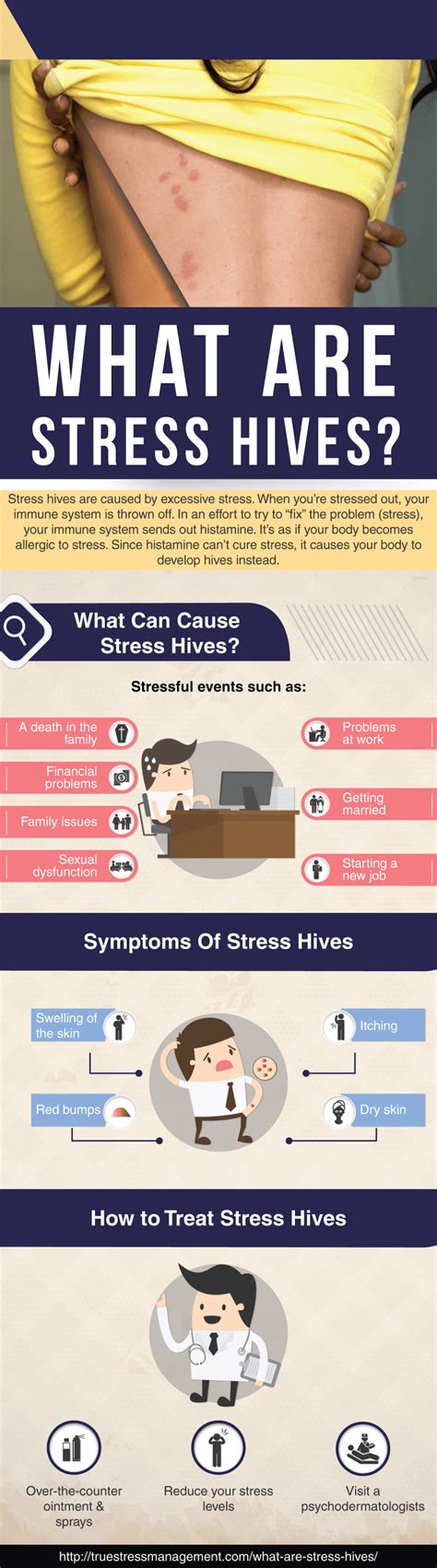 What Are Stress Hives True Stress Management