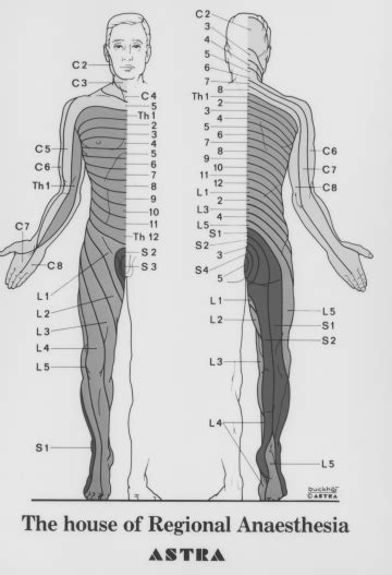 Dermatome Chart Human Body Anatomy Nurse Medical Male Sketch Chart My