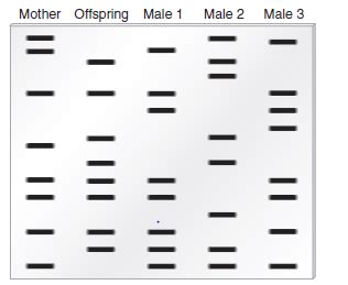 Dna profiling, dna testing, dna analysis, genetic profile, dna identification, genetic fingerprinting, and genetic analysis are some of the popular names used for dna fingerprinting. Solved: Here are traditional DNA fingerprints of five ...