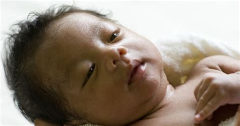 Circumcision Benefits Outweigh Risks Says CDC Today S Parent