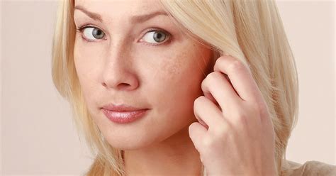 Entfernen sie pigmentflecken im gesicht mit pigmentclar produkten von la roche posay und finden sie eine passende dermatologische antwort auf ihre fragen. Pigmentflecken im Gesicht - dm Online Shop Magazin