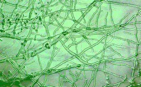 Evolutionary Stability In Mycorrhizal Endobacteria