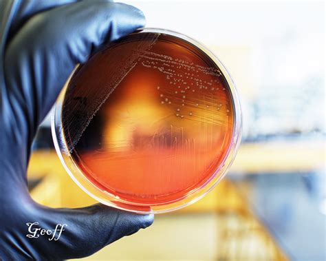 Listeria Monocytogenes Isolated On Palcam Agar Food Pathog Flickr