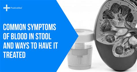 Common Symptoms Of Blood In Stool And Ways To Have It Treated Positivemed