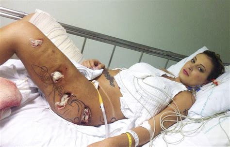 Andressa urach rebate críticas por procedimento estético: IMAGENS FORTES! Fotos de Andressa Urach ainda no hospital ...
