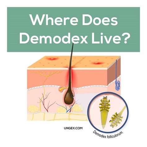 90 Amazing What Are Demodex Mites In Humans Insectza