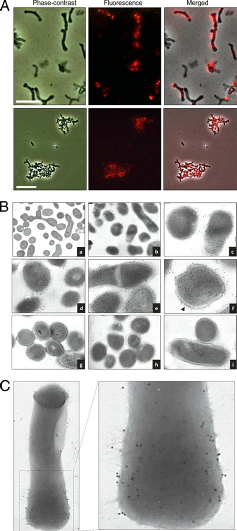 Localization Of The Tgaa Protein In B Bifidum Mimbb75 Cells By