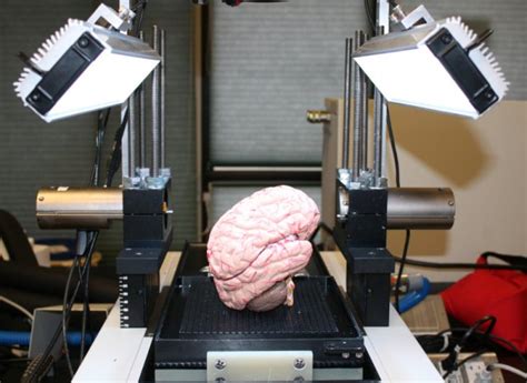 To Digitize A Brain First Slice 2000 Times With A Very Sharp Blade