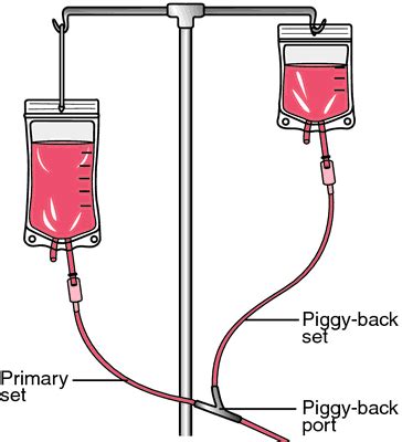 Intravenous Iv Therapy Iv Piggybacknursing File Nursing File