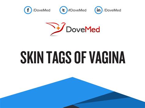 Skin Tags Of Vagina
