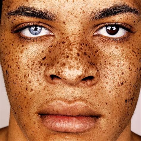 Unique Features Of Human Skin Have Always Fascinated London Based Photographer Brock Elbank In