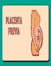 Understanding Placenta Previa Causes Nursing Interventions Course Hero