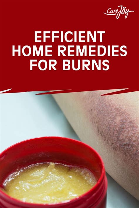 Efficient Home Remedies For Burns Home Remedies For Burns Home