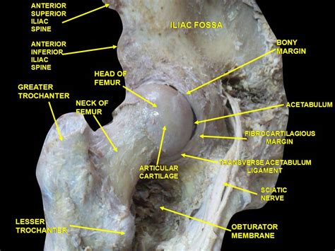Neck Of Femur Fracture Pathophysiology Wikidoc