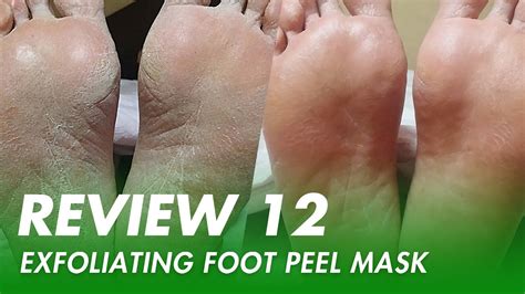 리뷰 악어발팩 리뷰 12 Exfoliating Foot Peel Mask Review Youtube